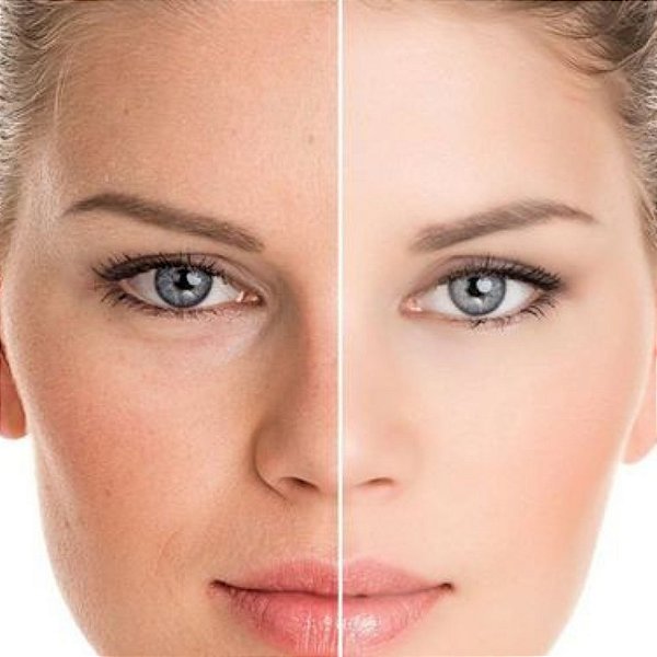 Skinbooster