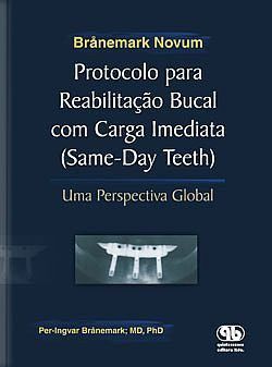 Livro Protocolo para Reabilitação Bucal com Carga Imediata - Branemark Novum