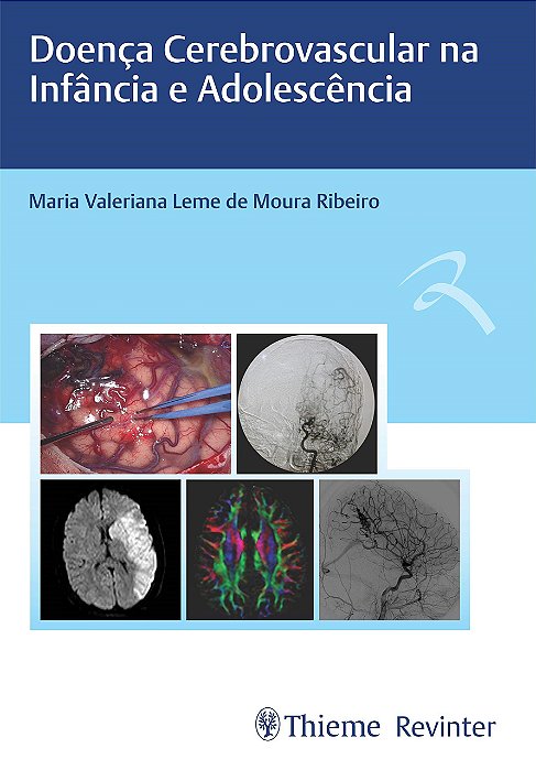 Livro Doenca Cerebrovascular Na Infancia e Adolescencia - Ribeiro