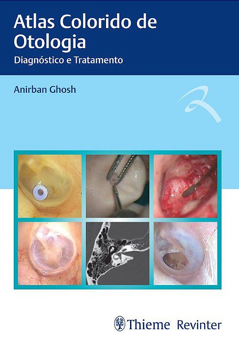 Livro Atlas Colorido de Otologia Diagnóstico e Tratamento