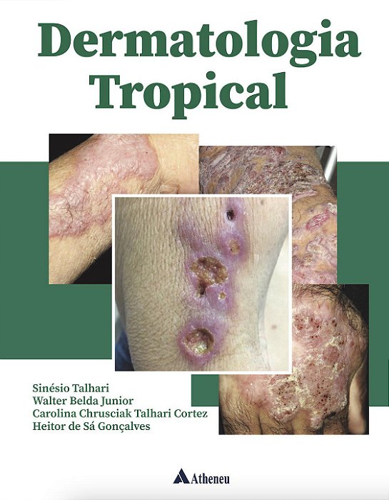Livro Dermatologia Tropical - Talhari/belda Junior