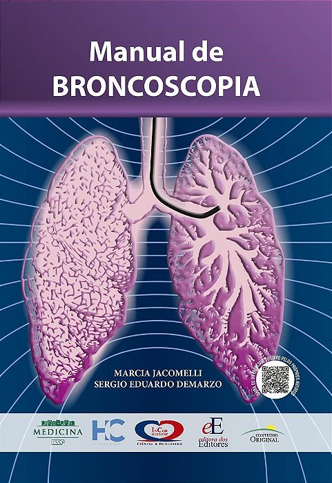 Livro Manual De Broncoscopia FMUSP