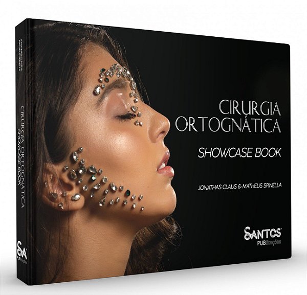 Livro Cirurgia Ortognática - Matheus - Santos Pub