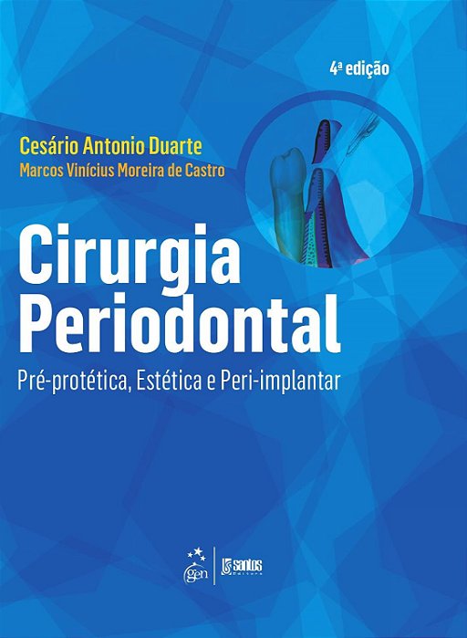 Livro Cirurgia Periodontal Pré-protética, Estética e Peri-implantar: Duarte/Santos