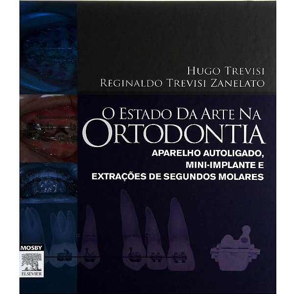 Livro Estado da Arte Na Ortodontia, O - Trevisi ***
