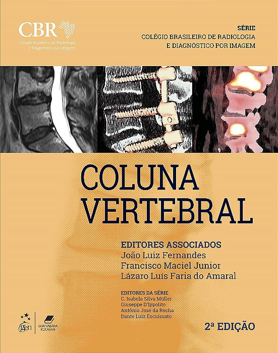 Livro Cbr - Coluna - Cbr