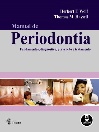 Livro Manual de Periodontia - Fundamentos, Diagnostico, Prevencao e Tratamento - Wolf/hassell