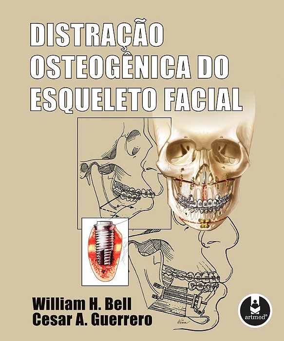 Livro Distracao Osteogenica do Esqueleto Facial - Bell/guerrero