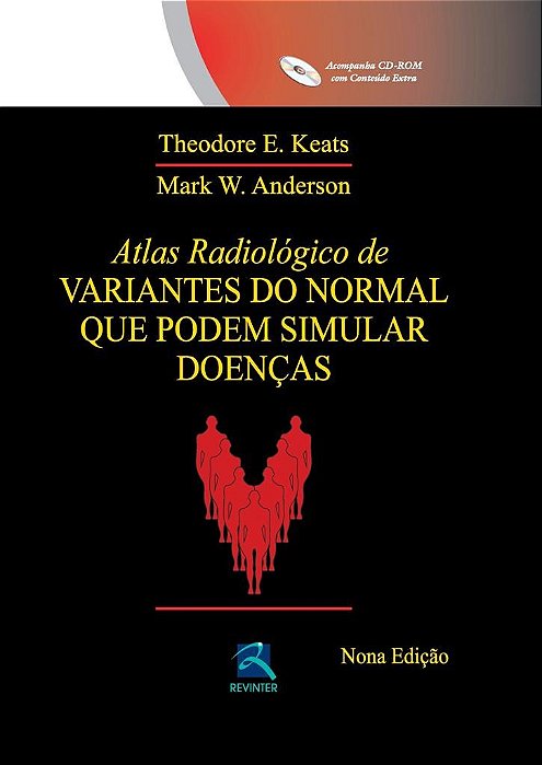 Livro Atlas Radiológico de Variantes do Normal Que Podem Simular Doenças - Keats