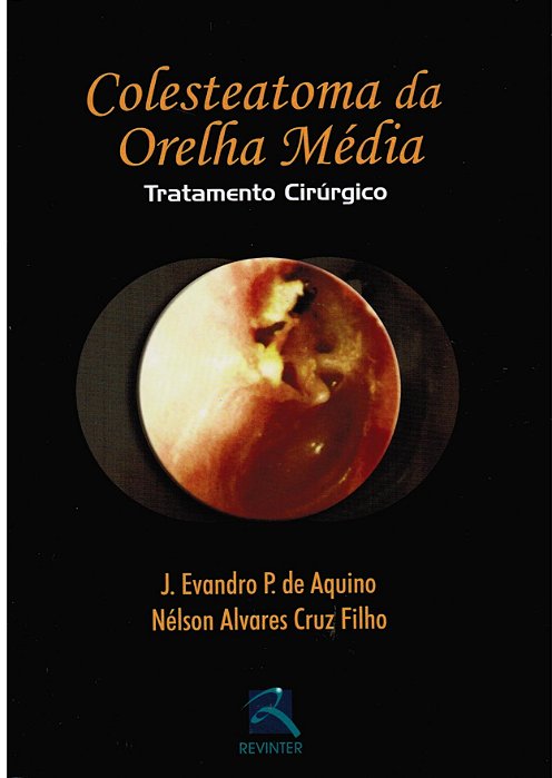 Livro Colesteatoma da Orelha Media - Aquino