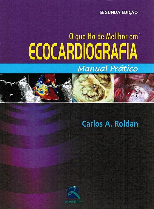 Livro Que Ha de Melhor em Ecocardiograma, O - Roldan