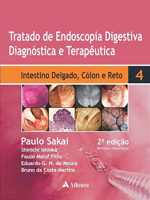 Livro Tratado de Endoscopia Digestiva Intestino Delgado, Cólon e Reto Vol IV