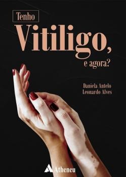 Livro Tenho Vitiligo, e Agora - Alves / Antelo