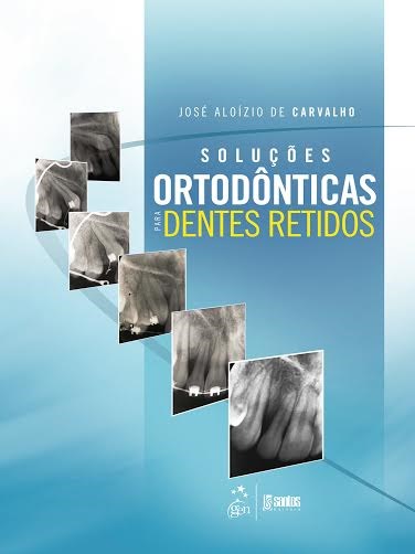 Livro Soluções Ortodônticas para Dentes Retidos - Carvalho