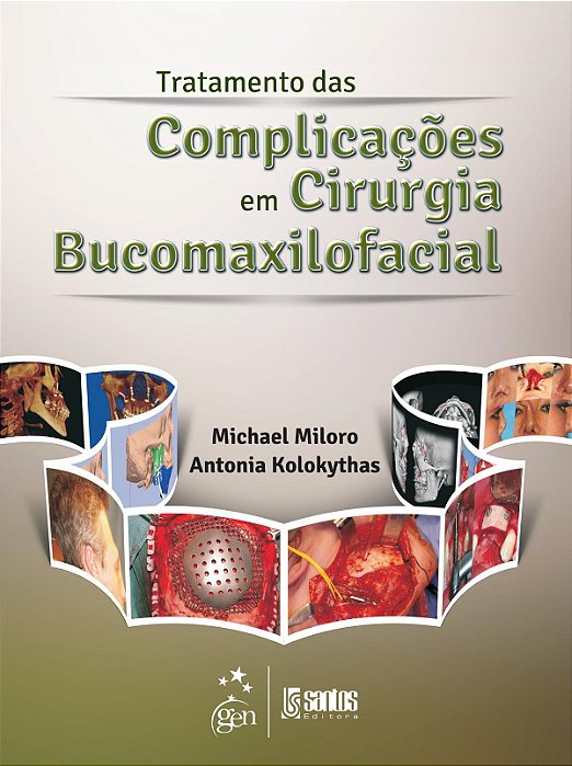 Livro Tratamento das Complicações em Cirurgia Bucomaxilofacial: Miloro