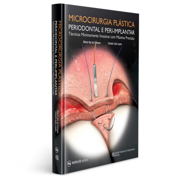 Livro Microcirurgia Plastica Periodontal e Peri-implantar Tecnicas Minimamente In - Campos/lopes