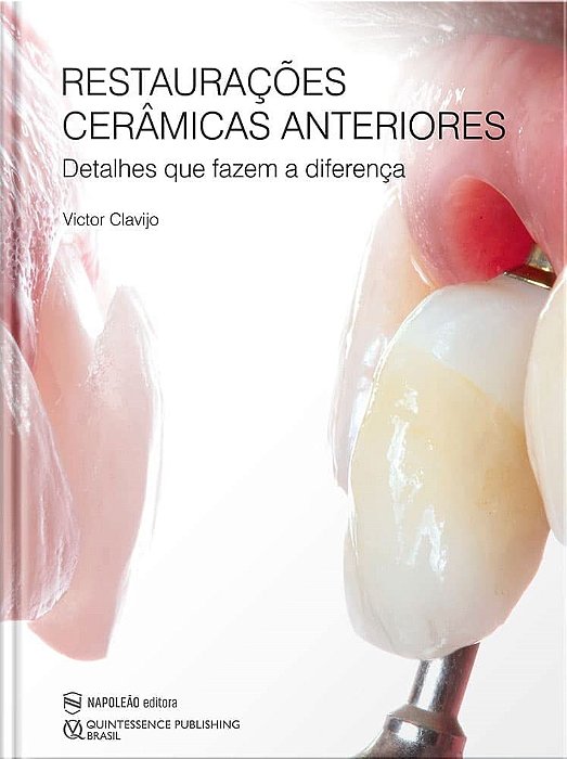 Livro Restauracoes Ceramicas Anteriores: Detalhes Que Fazem a Diferenca - Clavijo