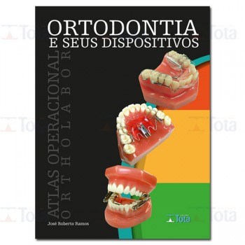 Livro Ortodontia e Seus Dispositivos: Atlas Operacional Ortholabor