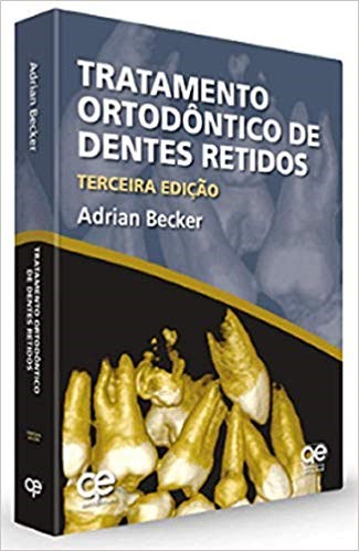 Livro Tratamento Ortodontico de Dentes Retidos - Becker