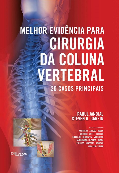 Livro Melhor Evidência para Cirurgia da Coluna Vertebral: 20 Casos Principais