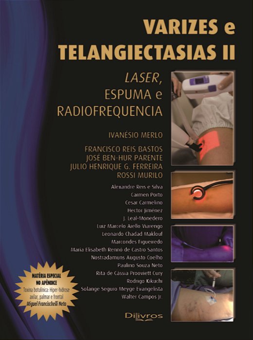 Varizes e Telangiectasias Ii - Laser, Espuma e Radiofrequência - Merlo - Dilivros