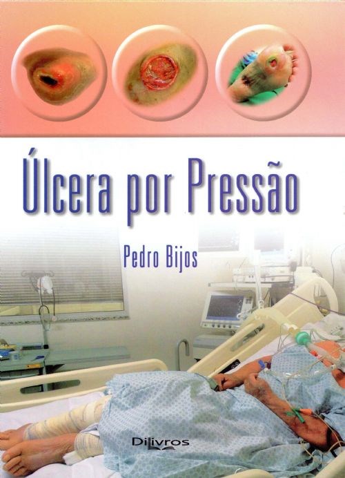Livro Úlcera por Pressão ***   Bijos