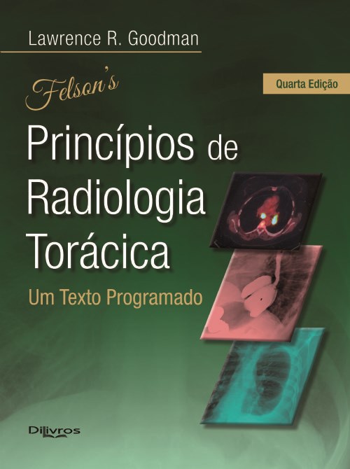 Livro Felson Princípios de Radiologia Torácica