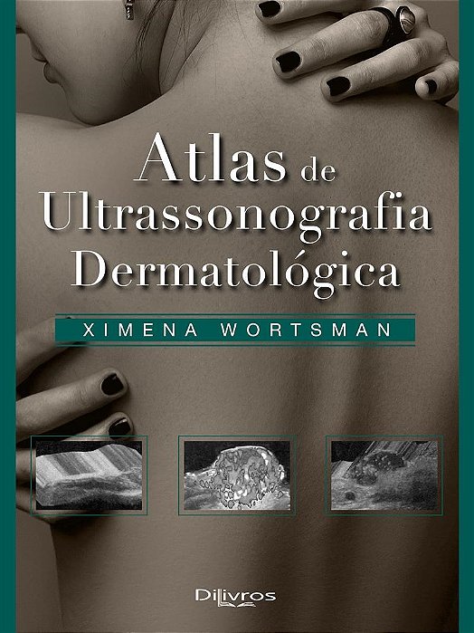 Livro Atlas de Ultrasonografia Dermatológica - Wortsman - Dilivros