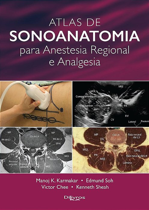 Livro Atlas de Sonoanatomia para Anestesia Regional e Analgesia  Karmakar