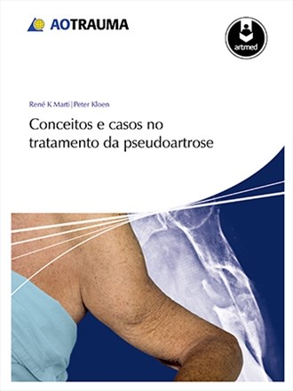 Livro Conceitos e Casos No Tratamento da Pseudoartrose - Marti/kloen