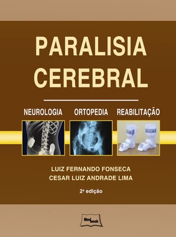 Livro Paralisia Cerebral Fonseca