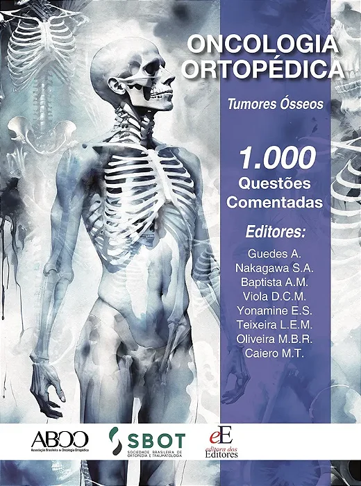 Livro Oncologia Ortopédica Tumores Ósseos: 1.000 Questões  Comentadas