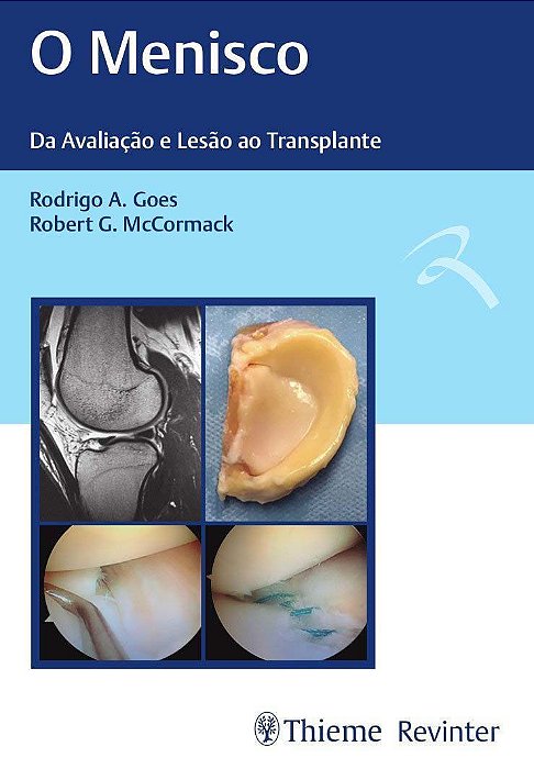 o Menisco - Da Avaliação e Lesão Ao Transplante