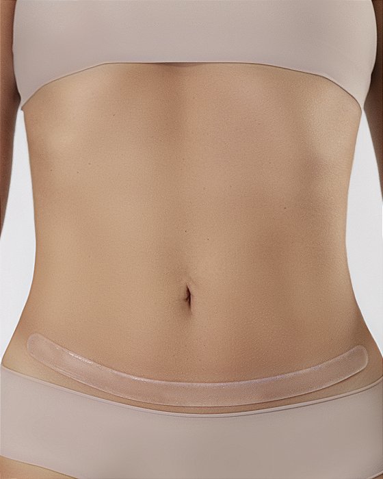 Fitas de Silicone 30cm ModelleSkin – Redução de Cicatrizes