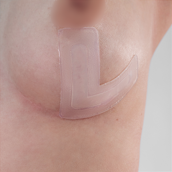 Fita de silicone em L para Mamas Siliskin – Tratamento de Cicatrizes (2 unidades)