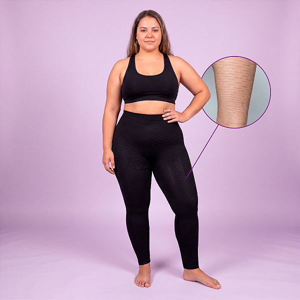 Calça com Relevos Ondulados para Lipedema ModelleSkin