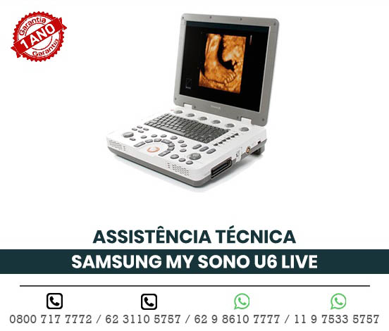 ASSISTENCIA TECNICA ULTRASSOM PORTATIL SAMSUNG MEDISON MY SONO U6 LIVE