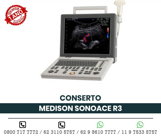CONSERTO ULTRASSOM PORTATIL MEDISON SONOACE R3
