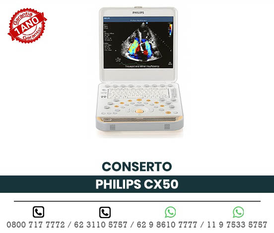 CONSERTO ULTRASSOM PORTATIL PHILIPS CX50