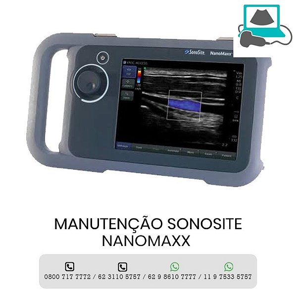 MANUTENCAO ULTRASSOM SONOSITE NANOMAXX