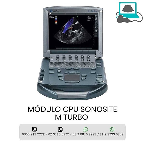 MODULO CPU ULTRASSOM PORATIL SONOSITE M TURBO