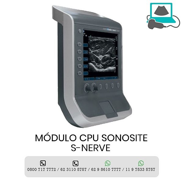 MODULO CPU ULTRASSOM PORATIL SONOSITE S NERVE
