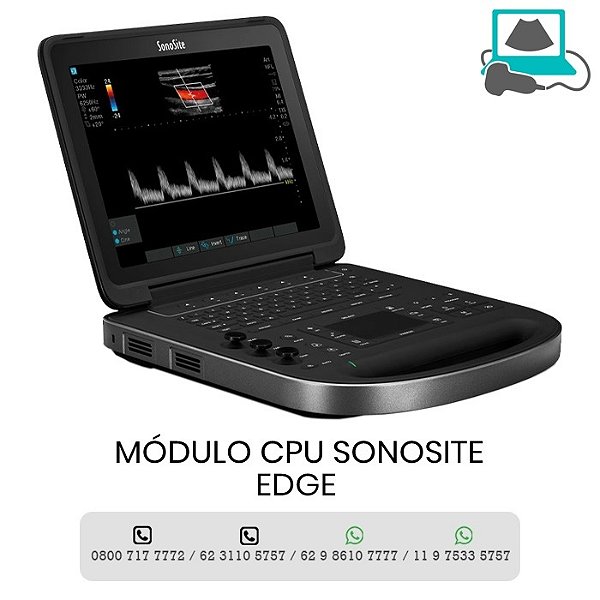 MODULO CPU ULTRASSOM SONOSITE EDGE