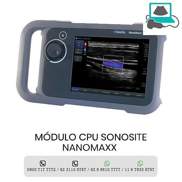 MODULO CPU ULTRASSOM SONOSITE NANOMAXX