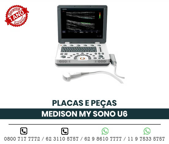 PLACAS PECAS ULTRASSOM PORTATIL MEDISON MY SONO U6