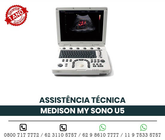ULTRASSOM PORTATIL MEDISON MY SONO U5