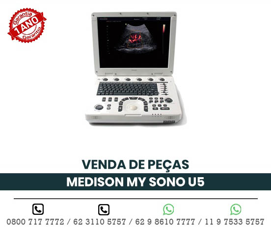 VENDA PECAS ULTRASSOM PORTATIL MEDISON MY SONO U5