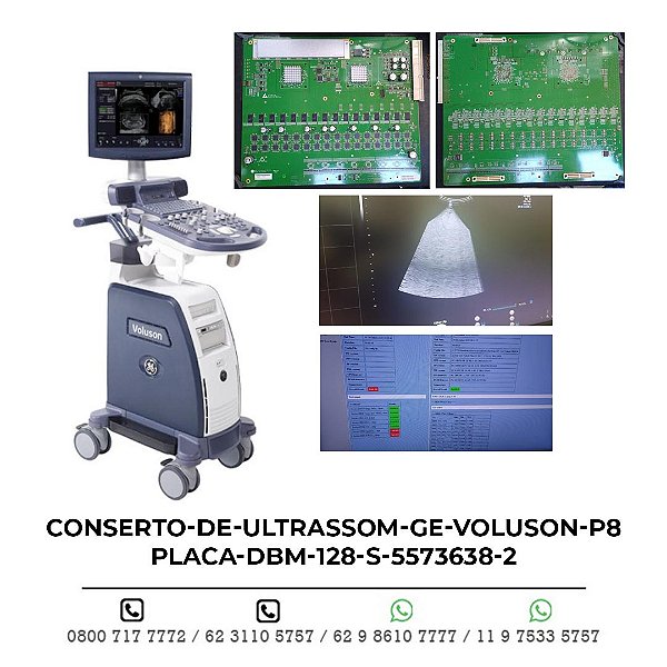 CONSERTO DE ULTRASSOM GE VOLUSON P8 PLACA DBM 128 S 5573638-2