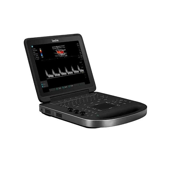 ASSISTENCIA TECNICA ULTRASSOM PORTATIL SONOSITE EDGE