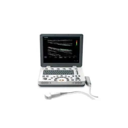 REPARO ULTRASSOM PORTATIL SAMSUNG MEDISON SONOACE U6